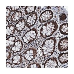 RPUSD4, Rabbit, Polyclonal Antibody, Abnova 100&mu;L; Unlabeled:Antibodies,