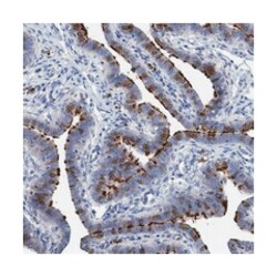 TCTN2 Rabbit anti-Human, Polyclonal Antibody, Abnova 100&mu;L; Unlabeled:Antibodies,