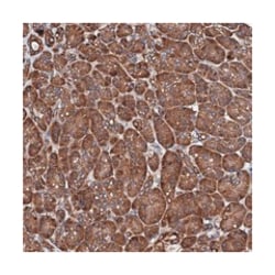 CKAP5 Rabbit anti-Human, Polyclonal Antibody, Abnova 100 &mu;L | Buy Online | Abnova Corporation | Fisher Scientific