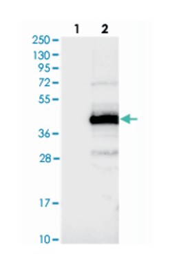 C11orf49 Rabbit anti-Human, Polyclonal Antibody, Abnova 100 &mu;L | Buy Online | Abnova Corporation | Fisher Scientific