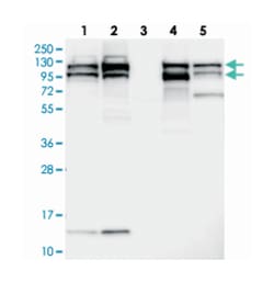 SEC24C Rabbit anti-Human, Polyclonal Antibody, Abnova 100&mu;L; Unlabeled:Antibodies,
