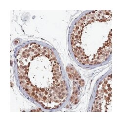 CLPX, Rabbit, Polyclonal Antibody, Abnova 100 &mu;L | Buy Online | Abnova Corporation | Fisher Scientific