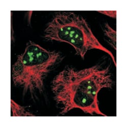UBXN6 Rabbit anti-Human, Polyclonal Antibody, Abnova 100&mu;L; Unlabeled:Antibodies,