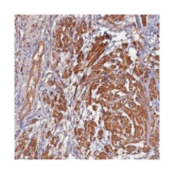 FUZ Rabbit anti-Human, Polyclonal Antibody, Abnova 100&mu;L; Unlabeled:Antibodies,