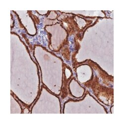 MEMO1, Rabbit, Polyclonal Antibody, Abnova 100&mu;L; Unlabeled:Antibodies,