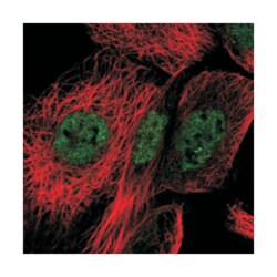 BANF2, Rabbit, Polyclonal Antibody, Abnova 100&mu;L; Unlabeled:Antibodies,