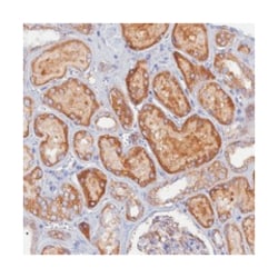 CACNA1B, Rabbit, Polyclonal Antibody, Abnova 100 &mu;L | Buy Online | Abnova Corporation | Fisher Scientific