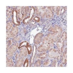 COX20 Rabbit anti-Human, Polyclonal Antibody, Abnova 100 &mu;L | Buy Online | Abnova Corporation | Fisher Scientific