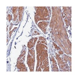YEATS2, Rabbit, Polyclonal Antibody, Abnova 100&mu;L; Unlabeled:Antibodies,