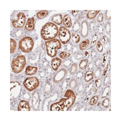 GABRE, Rabbit, Polyclonal Antibody, Abnova 100&mu;L; Unlabeled:Antibodies,