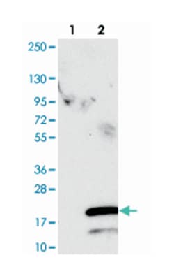SPCS1, Rabbit, Polyclonal Antibody, Abnova 100&mu;L; Unlabeled:Antibodies,