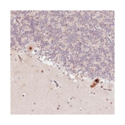 CCNYL1, Rabbit, Polyclonal Antibody, Abnova 100 &mu;L | Buy Online | Abnova Corporation | Fisher Scientific