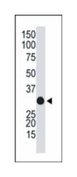 APOBEC1, Rabbit, Polyclonal Antibody, Abnova 400 &mu;L | Buy Online | Abnova Corporation | Fisher Scientific