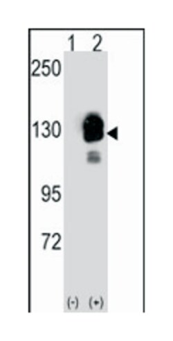 CDH8, Rabbit, Polyclonal Antibody, Abnova 400&mu;L; Unlabeled:Antibodies,