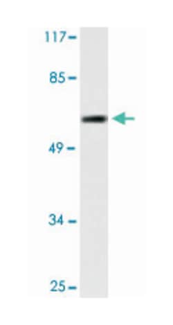 TP53 Rabbit anti-Human, Polyclonal Antibody, Abnova 100 &mu;L | Buy Online | Abnova Corporation | Fisher Scientific