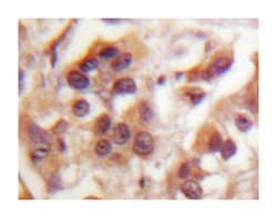 IKBKG Rabbit anti-Human, Polyclonal Antibody, Abnova 100 &mu;L | Buy Online | Abnova Corporation | Fisher Scientific
