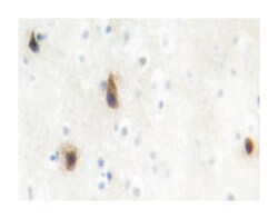 MVK Rabbit anti-Human, Polyclonal Antibody, Abnova 100&mu;L; Unlabeled:Antibodies,
