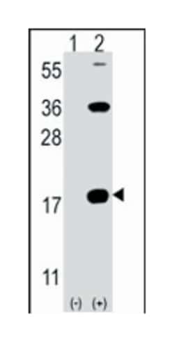 CD247 Rabbit anti-Human, Polyclonal Antibody, Abnova 400&mu;L; Unlabeled:Antibodies,