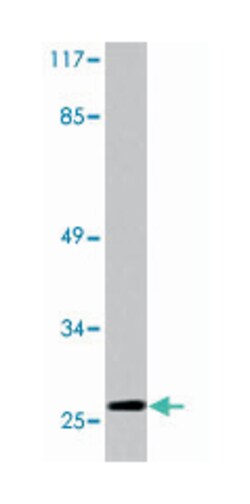 HSPB1 (phospho S78), Rabbit anti-Human, Polyclonal Antibody, Abnova 100&mu;L;