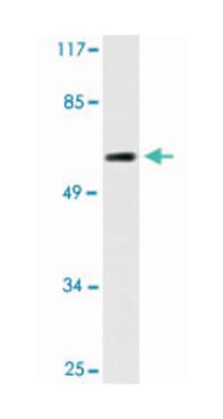 CLCC1 Rabbit anti-Human, Polyclonal Antibody, Abnova 100 &mu;L | Buy Online | Abnova Corporation | Fisher Scientific