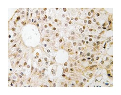 CD3EAP, Rabbit, Polyclonal Antibody, Abnova 100 &mu;L | Buy Online | Abnova | Fisher Scientific