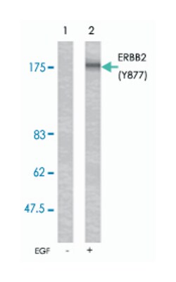 ERBB2 (phospho Y877), Rabbit anti-Human, Mouse, Rat, Polyclonal Antibody,