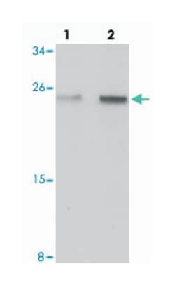 SPATA19, Chicken, Polyclonal Antibody, Abnova 100 &mu;g | Buy Online | Abnova Corporation | Fisher Scientific