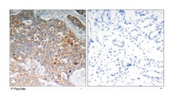 GSK3B (phospho Y216), Rabbit anti-Human, Mouse, Rat, Polyclonal Antibody,