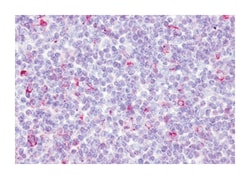 CCR10 Rabbit anti-Human, Polyclonal Antibody, Abnova 50 &mu;g | Buy Online | Abnova Corporation | Fisher Scientific