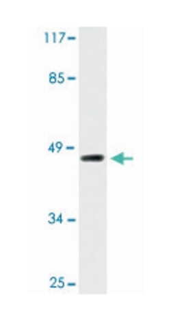 E2F2, Rabbit, Polyclonal Antibody, Abnova 100 &mu;L | Buy Online | Abnova Corporation | Fisher Scientific