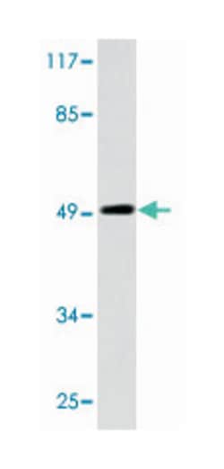 EPB49 Rabbit anti-Human, Mouse, Polyclonal Antibody, Abnova 100 &mu;L | Buy Online | Abnova Corporation | Fisher Scientific