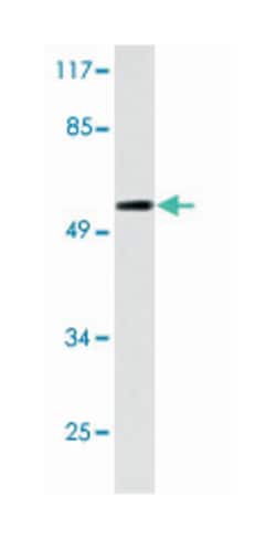 AIRE Rabbit anti-Human, Mouse, Polyclonal Antibody, Abnova 100&mu;L; Unlabeled:Antibodies,