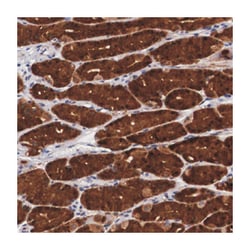 EMID1, Rabbit, Polyclonal Antibody, Abnova 100 &mu;L | Buy Online | Abnova Corporation | Fisher Scientific