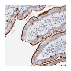 MGAM, Rabbit, Polyclonal Antibody, Abnova 100&mu;L; Unlabeled:Antibodies,