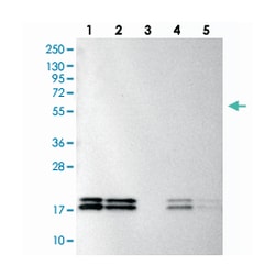 NME1-NME2, Rabbit, Polyclonal Antibody, Abnova 100&mu;L; Unlabeled:Antibodies,