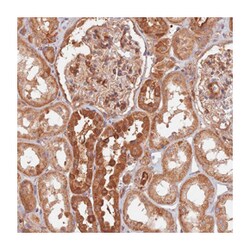 SAC3D1, Rabbit, Polyclonal Antibody, Abnova 100 &mu;L | Buy Online | Abnova Corporation | Fisher Scientific