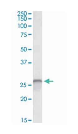 CALB1, Goat, Polyclonal Antibody, Abnova 100 &mu;g | Buy Online | Abnova Corporation | Fisher Scientific