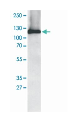 AP2A1 Goat anti-Chicken, Human, Mouse, Pig, Rat, Polyclonal Antibody, Abnova 100 &mu;g | Buy Online | Abnova Corporation | Fisher Scientific