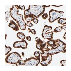 MAGEA10 Rabbit anti-Human, Polyclonal Antibody, Abnova 100 &mu;L | Buy Online | Abnova Corporation | Fisher Scientific
