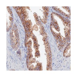 ARL16, Rabbit, Polyclonal Antibody, Abnova 100 &mu;L | Buy Online | Abnova Corporation | Fisher Scientific