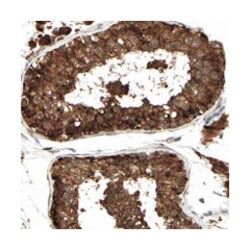 CARKD, Rabbit, Polyclonal Antibody, Abnova 100 &mu;L | Buy Online | Abnova Corporation | Fisher Scientific