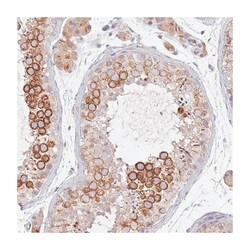 NMUR2 Rabbit anti-Human, Polyclonal Antibody, Abnova 100&mu;L; Unlabeled:Antibodies,