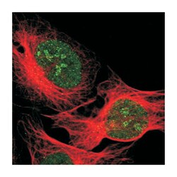 DLG3, Rabbit, Polyclonal Antibody, Abnova 100&mu;L; Unlabeled:Antibodies,