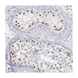 SOX9 Rabbit anti-Human, Mouse, Rat, Polyclonal Antibody, Abnova 100 &mu;L | Buy Online | Abnova Corporation | Fisher Scientific