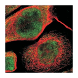 TAF7L, Rabbit, Polyclonal Antibody, Abnova 100 &mu;L | Buy Online | Abnova Corporation | Fisher Scientific