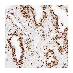 ILF3 Rabbit anti-Human, Mouse, Rat, Polyclonal Antibody, Abnova 100&mu;L;