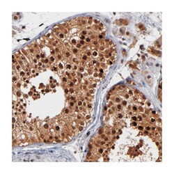 HUWE1 Rabbit anti-Human, Polyclonal Antibody, Abnova 100μL; Unlabeled:Antibodies,