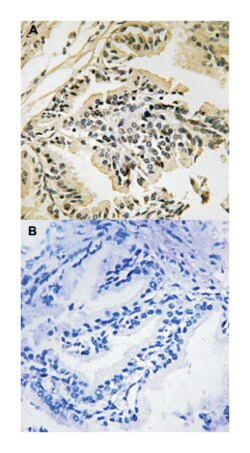 EIF2AK3 (phospho T982), Rabbit anti-Human, Mouse, Polyclonal Antibody,