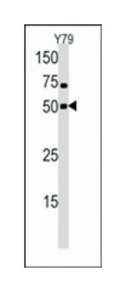 CLK1, Rabbit, Polyclonal Antibody, Abnova 400&mu;L; Unlabeled:Antibodies,