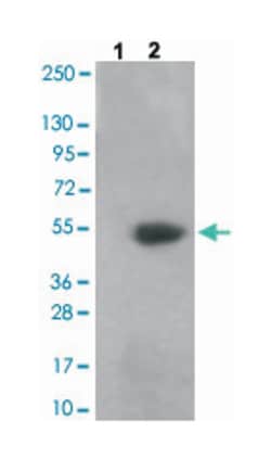 CAMK2A/CAMK2B/CAMK2D (phospho T305), Rabbit anti-Human, Mouse, Rat, Polyclonal